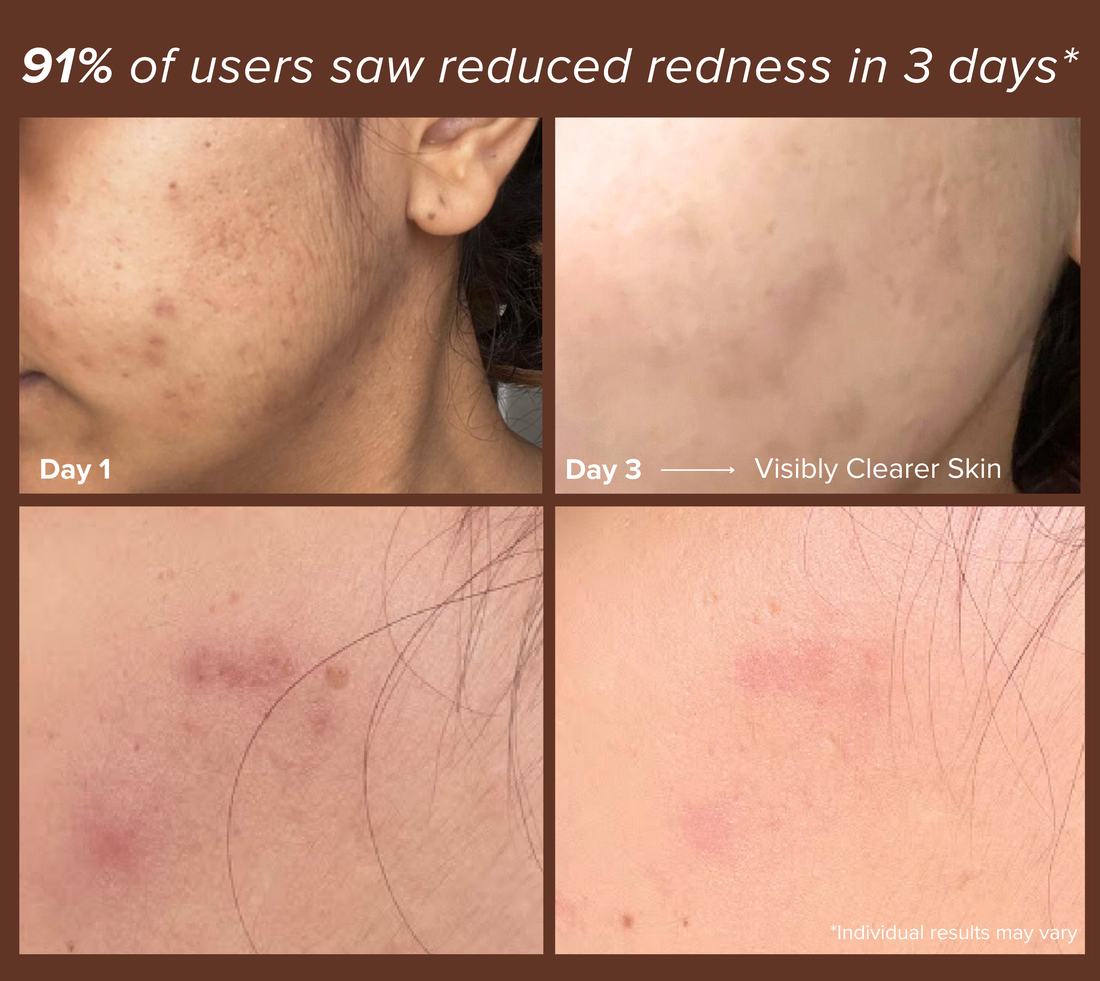 Dual Spot Treatment Serum